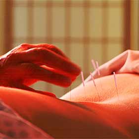 Acupuncture for Back pain