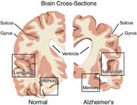 Brain Cross-Sections