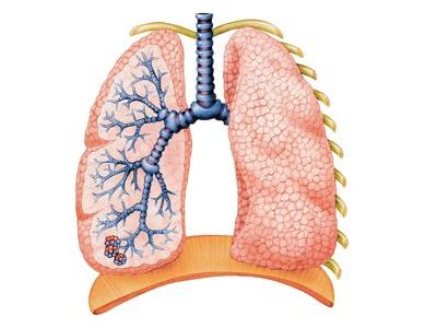 No Extra Oxygen for the Latest Artificial Lung Prototype