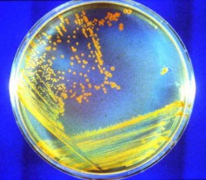 Predator-prey interaction recreated using bacteria