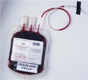 Old blood transfusion likely to cause health problems