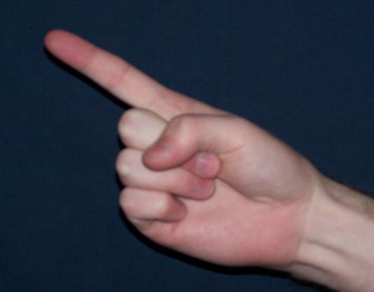 Korean Study Asserts Link Between A Man's Finger And His Manhood
