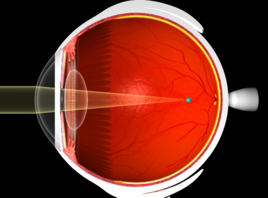 Absence of sunlight can make children myopic 