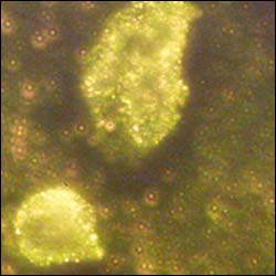 A quick way to detect melamine, using gold nano-particles identified by researchers 