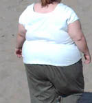 Obese Woman