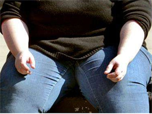 Obesity Taking Its Toll on Scottish Women