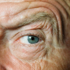 University of Michigan Health System study concludes that poor vision in elderly increases Alzheimer''s risk
