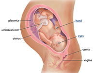 Pregnant women who suffer from preeclampsia have high risk of BP in later life  