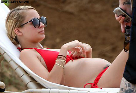 Vitamin D Levels of mother affect Baby's Dental Health