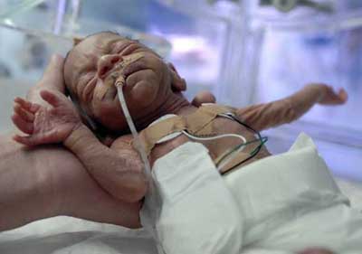 Couples cope differently following premature baby’s death