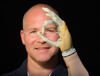Bio-engineered nerve-muscle connection to improve prosthetic hands