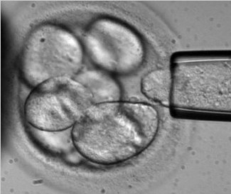 Stem cell banks gaining popularity as couples choose best health options for Kids
