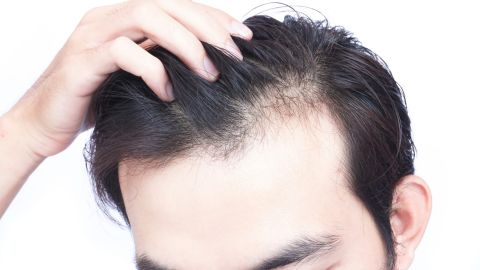 How to stop Hair Loss and Hair Thinning