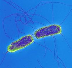 Bilestones Play Major Role In Perpetuating Typhoid Bacteria